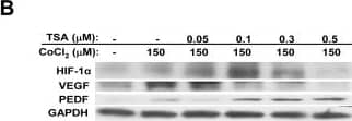 HIF-1 alpha Antibody (H1alpha67)