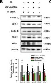 HIF-1 alpha Antibody (H1alpha67)