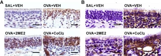 HIF-1 alpha Antibody (H1alpha67)