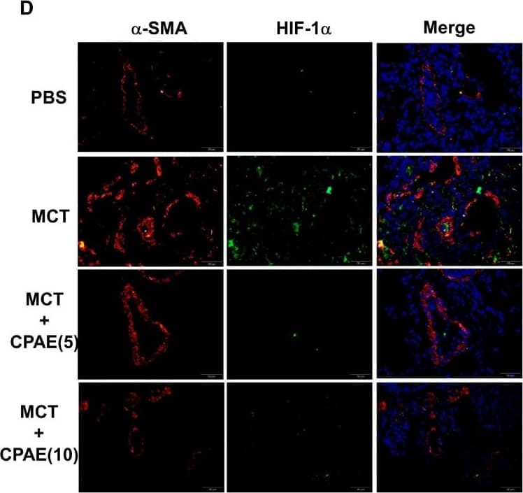 HIF-1 alpha Antibody (H1alpha67)