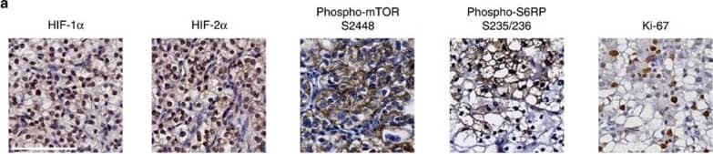 HIF-1 alpha Antibody (H1alpha67)