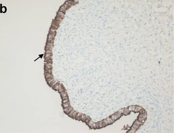 OGG1 Antibody - BSA Free