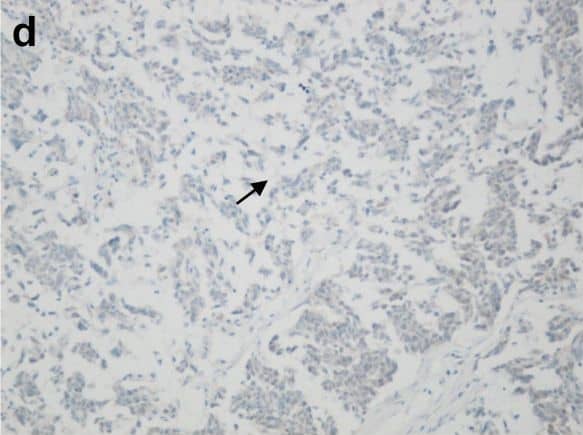 OGG1 Antibody - BSA Free