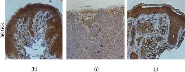 OGG1 Antibody - BSA Free