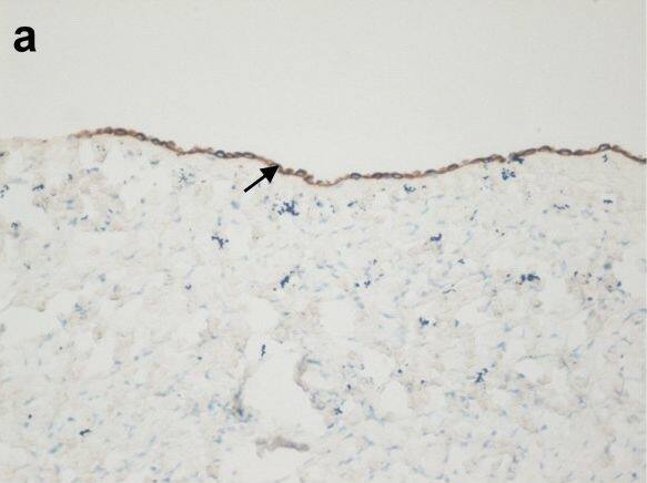 OGG1 Antibody - BSA Free