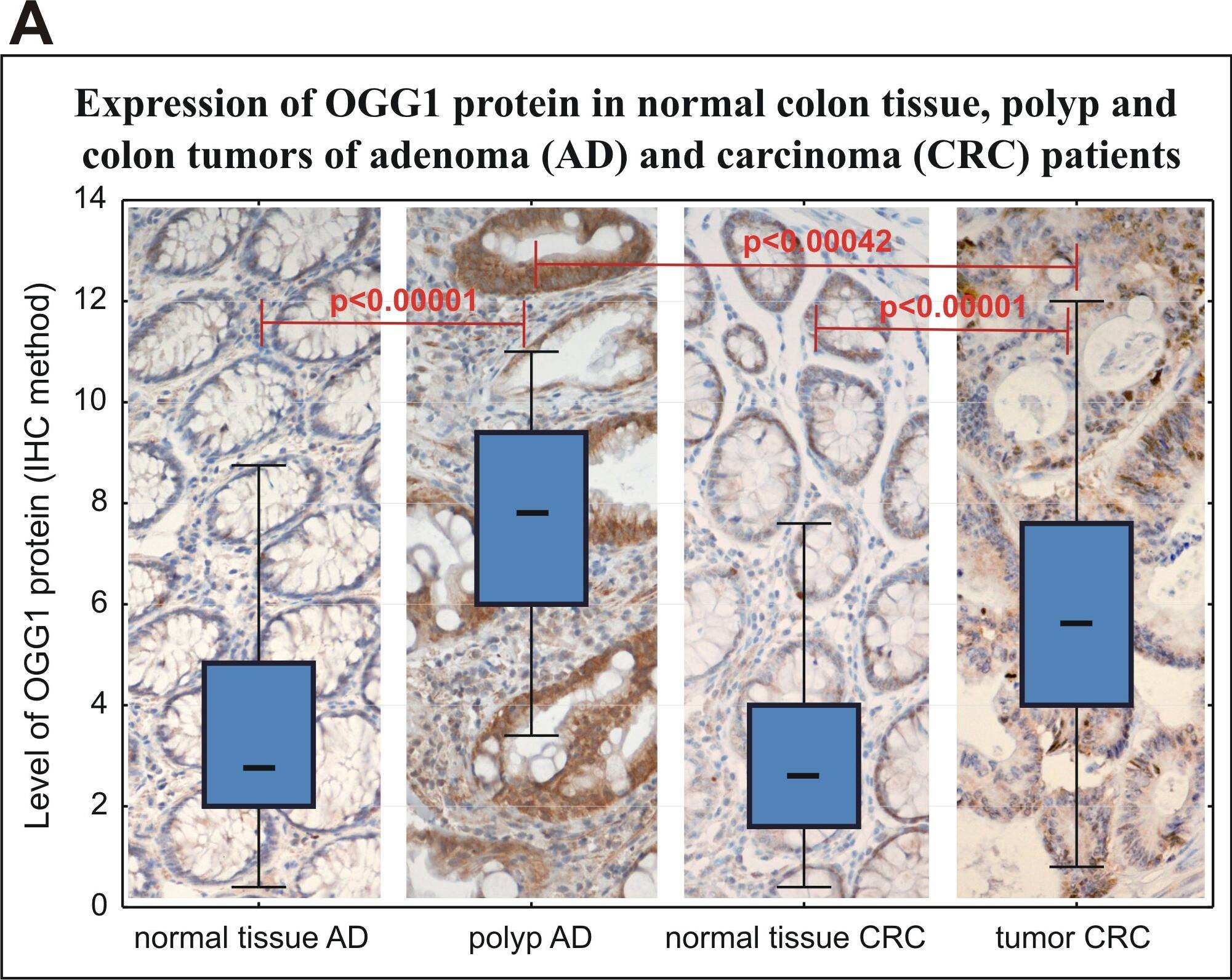 OGG1 Antibody - BSA Free