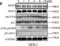 MTH1 Antibody - BSA Free