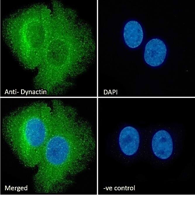 Dynactin Subunit 1/DCTN1 Antibody