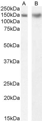 Dynactin Subunit 1/DCTN1 Antibody