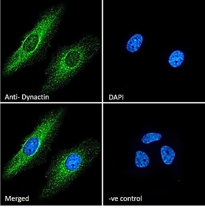 Dynactin Subunit 1/DCTN1 Antibody