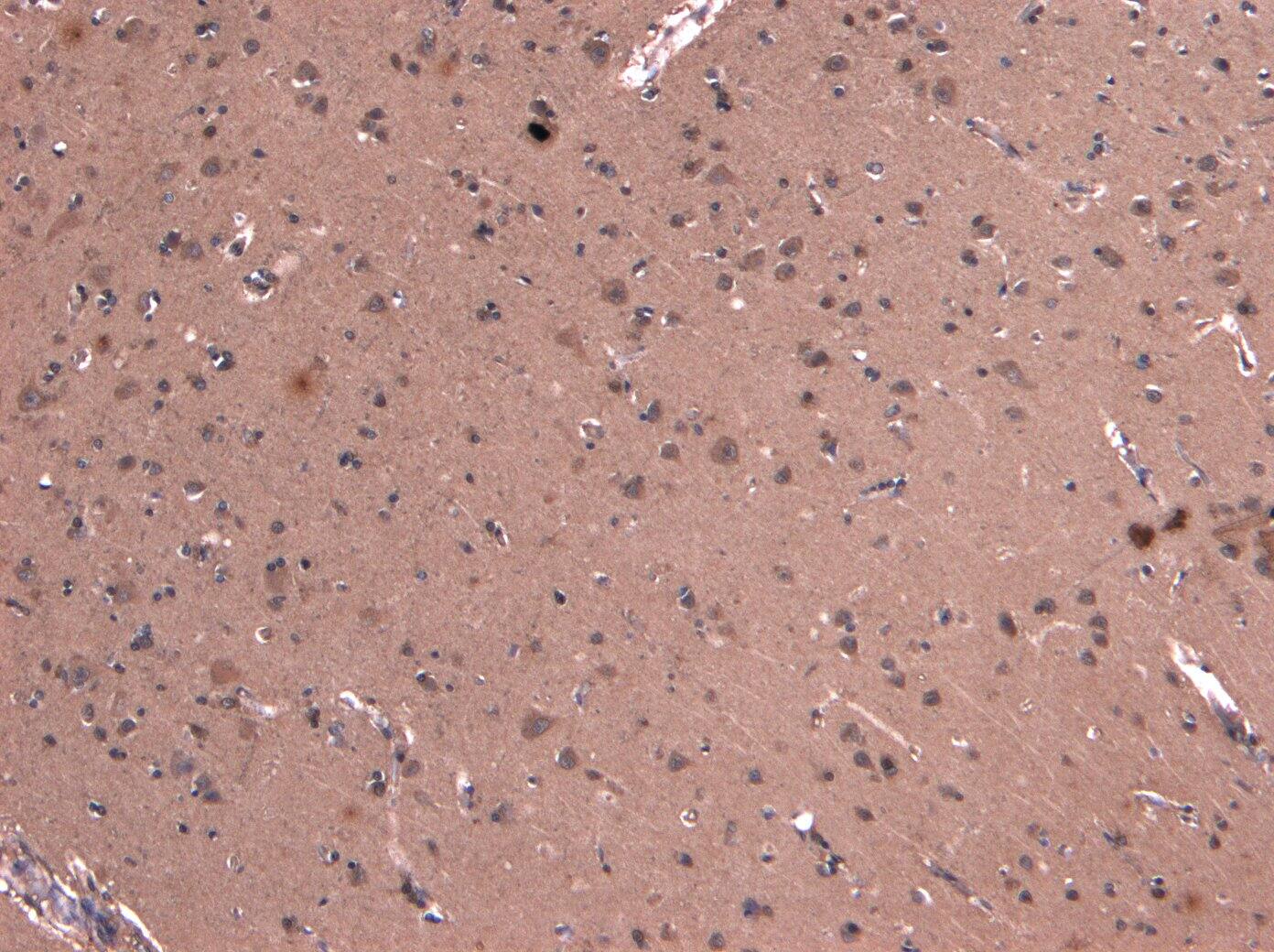 Dynactin Subunit 1/DCTN1 Antibody