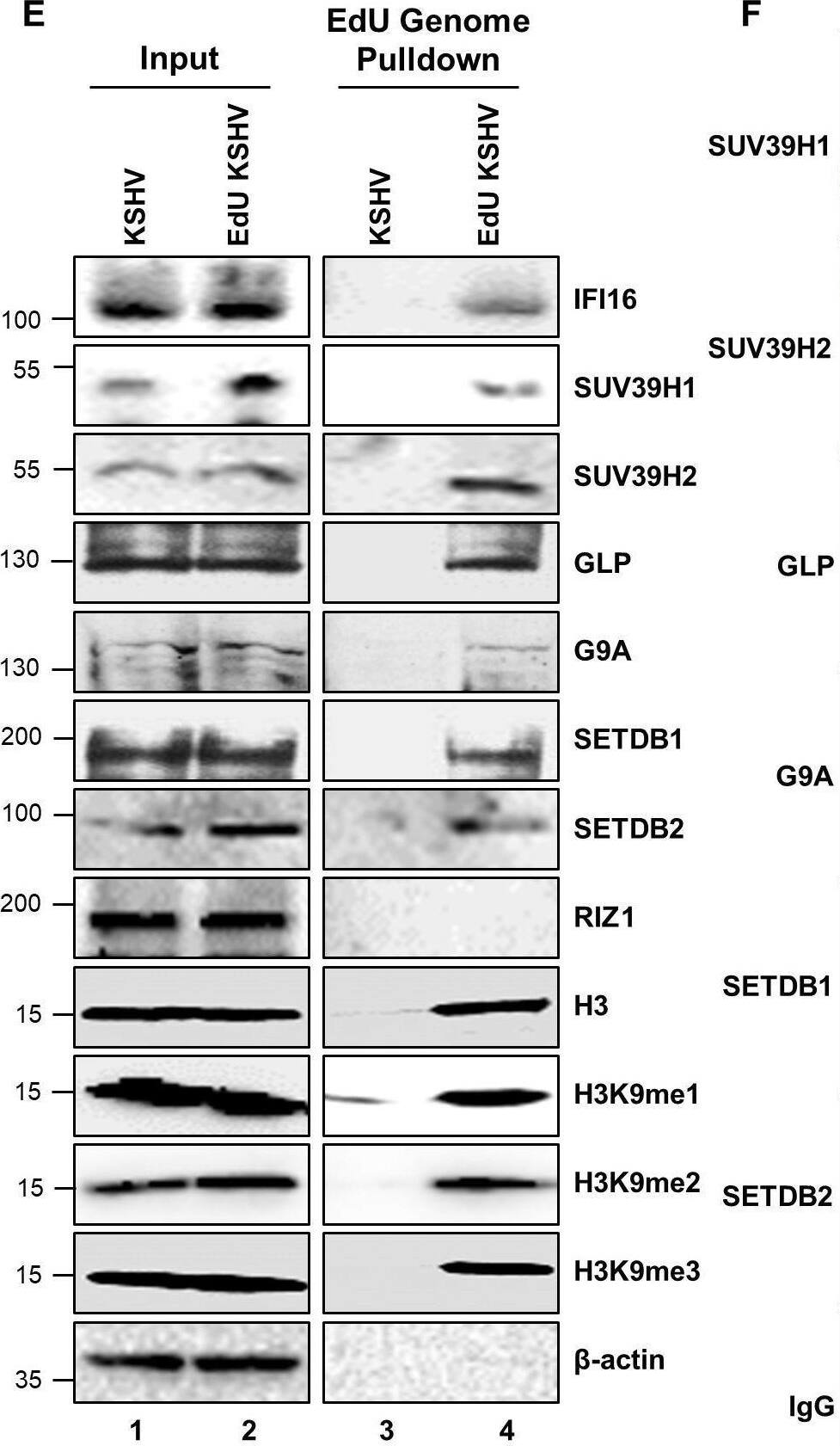 SETDB2 Antibody