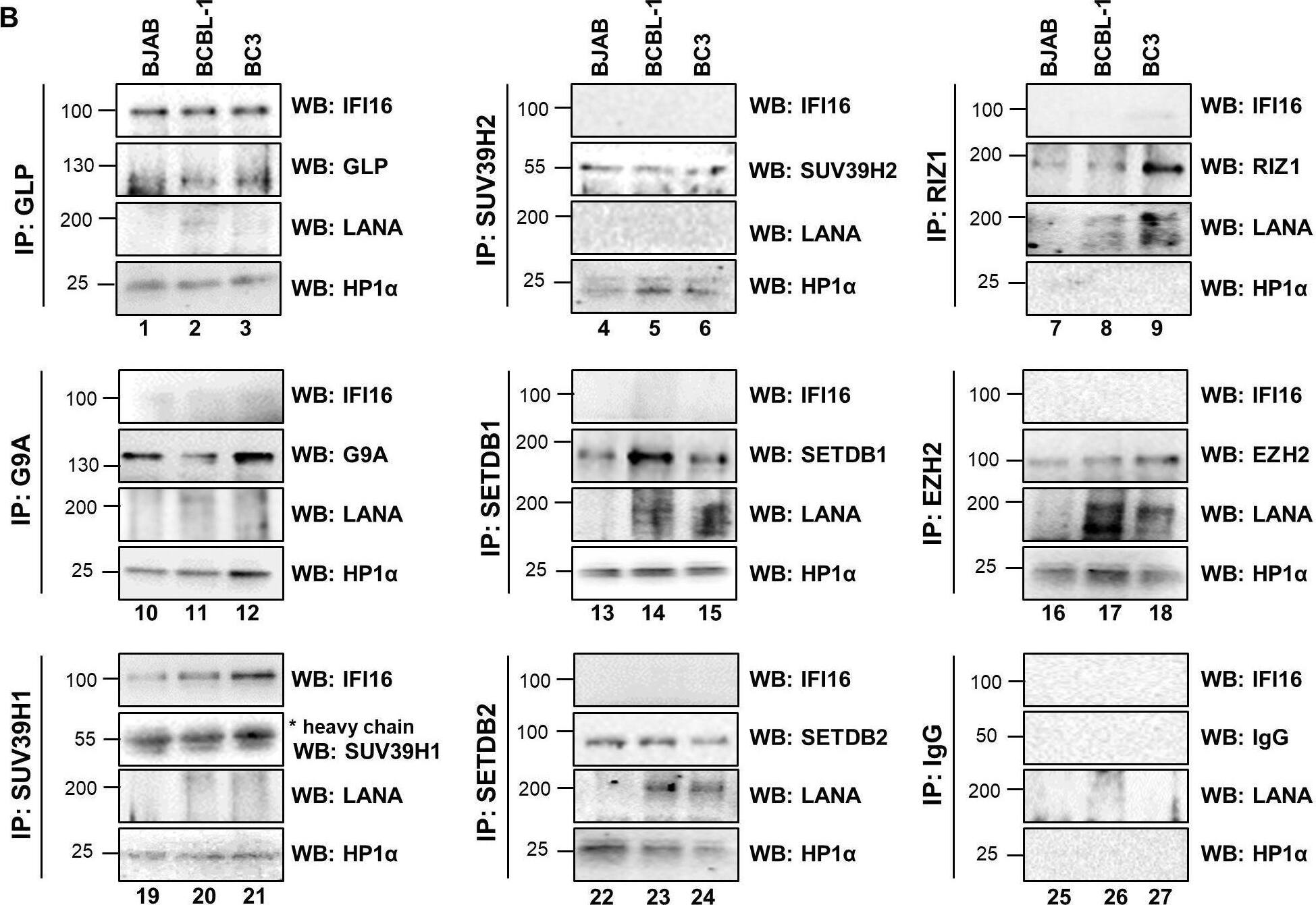 SETDB2 Antibody