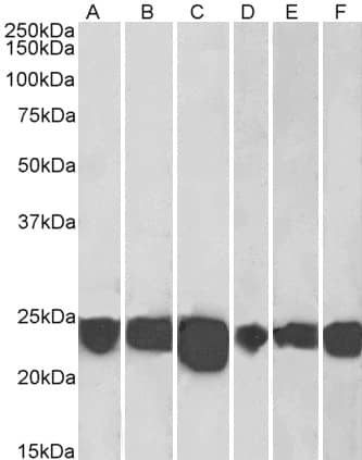 Park7/DJ-1 Antibody