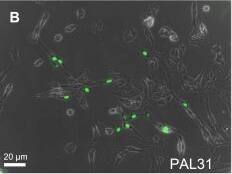 ANP32B Antibody
