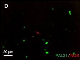 ANP32B Antibody