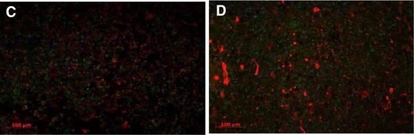 ANP32B Antibody