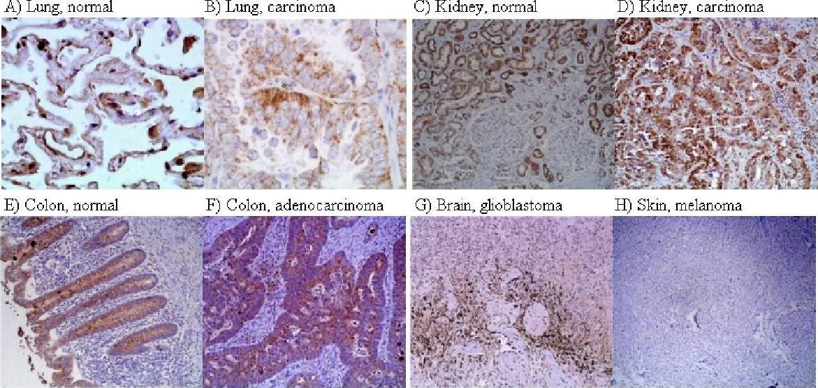 HIF-1 alpha Antibody (H1alpha67)