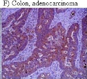HIF-1 alpha Antibody (H1alpha67)