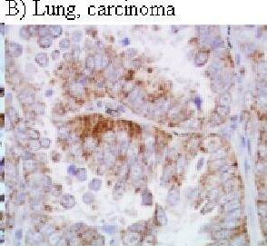 HIF-1 alpha Antibody (H1alpha67)