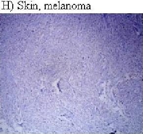 HIF-1 alpha Antibody (H1alpha67)
