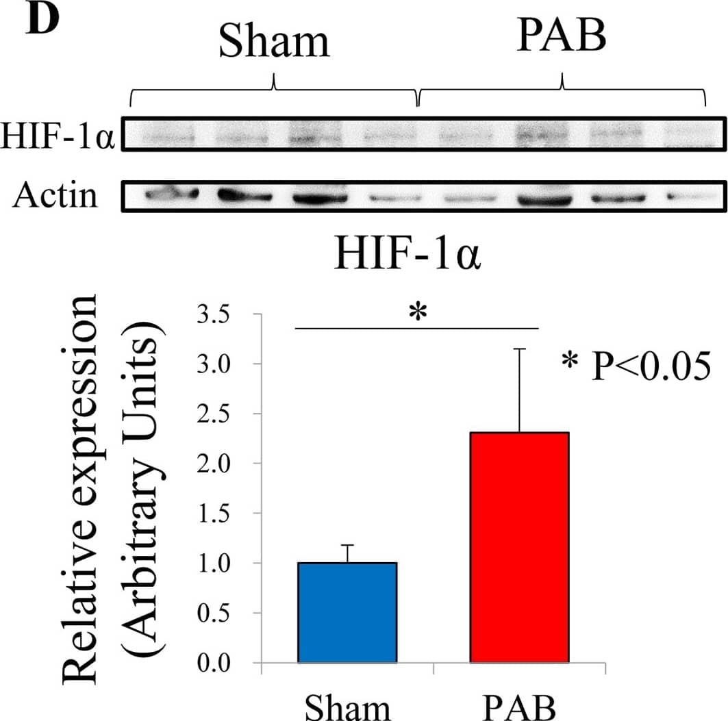 HIF-1 alpha Antibody (H1alpha67)