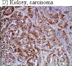 HIF-1 alpha Antibody (H1alpha67)