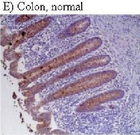 HIF-1 alpha Antibody (H1alpha67)