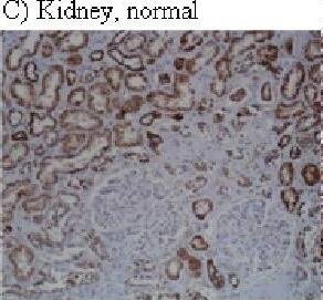 HIF-1 alpha Antibody (H1alpha67)