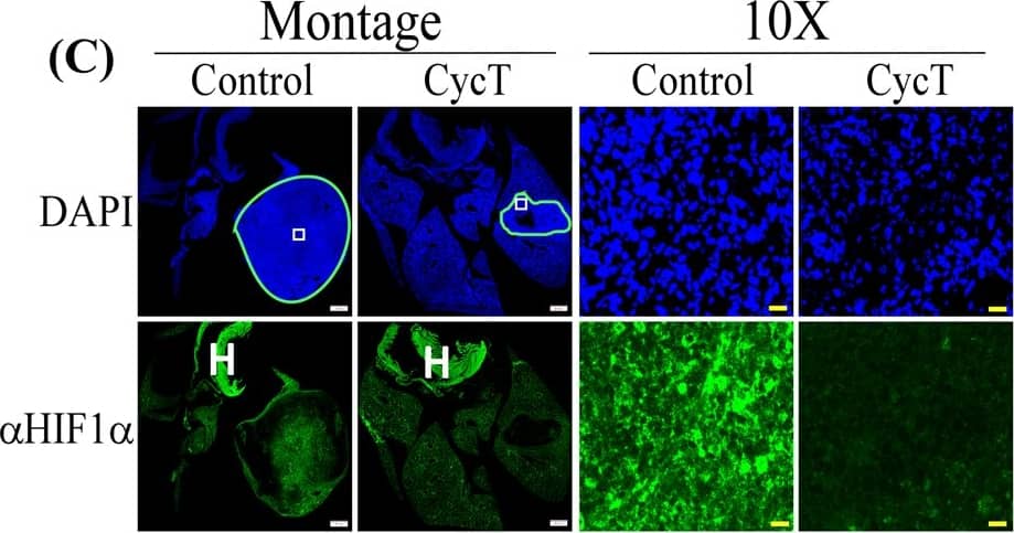HIF-1 alpha Antibody (H1alpha67)