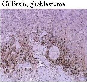 HIF-1 alpha Antibody (H1alpha67)