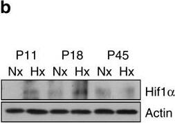 HIF-1 alpha Antibody (H1alpha67)