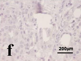 HIF-1 alpha Antibody (H1alpha67)