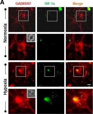 HIF-1 alpha Antibody (H1alpha67)