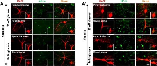 HIF-1 alpha Antibody (H1alpha67)