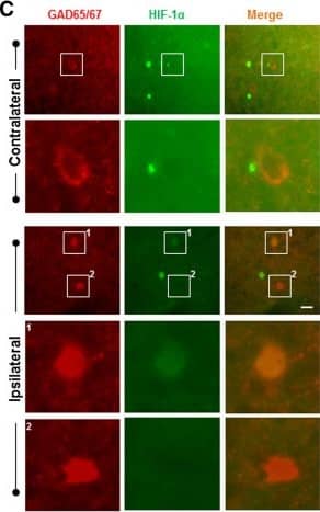 HIF-1 alpha Antibody (H1alpha67)