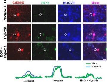 HIF-1 alpha Antibody (H1alpha67)