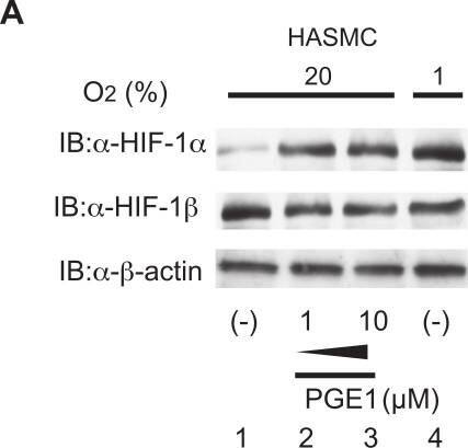 ARNT/HIF-1 beta Antibody (H1beta234) - BSA Free