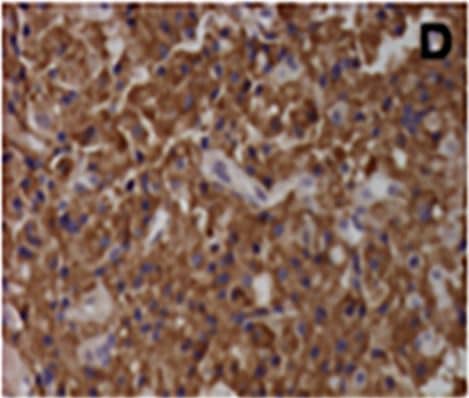 AIP/ARA9 Antibody (35-2)