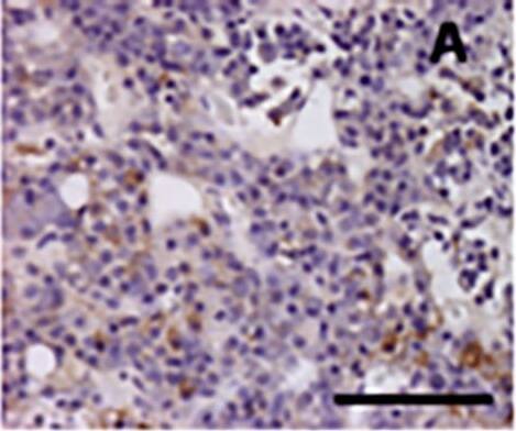 AIP/ARA9 Antibody (35-2)