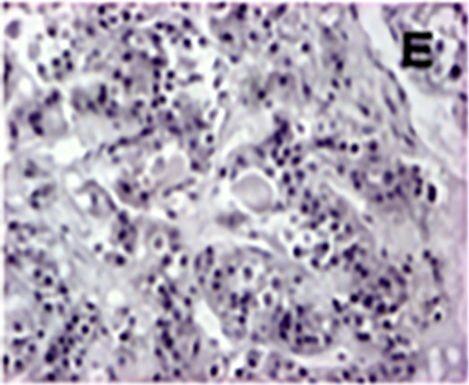 AIP/ARA9 Antibody (35-2)