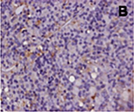 AIP/ARA9 Antibody (35-2)