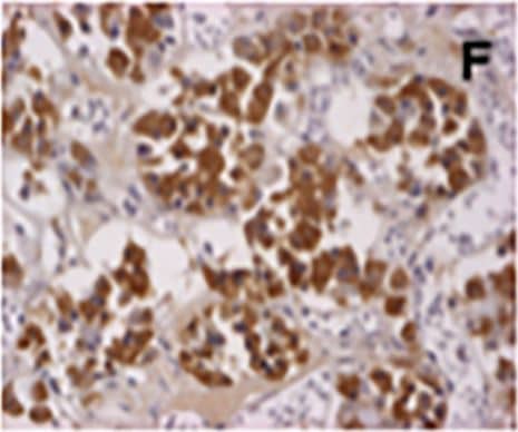 AIP/ARA9 Antibody (35-2)