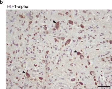 HIF-1 alpha Antibody (ESEE122)