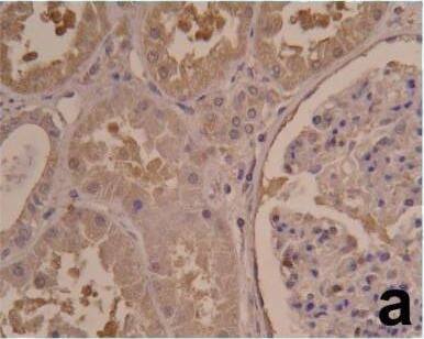 HIF-1 alpha Antibody (ESEE122)