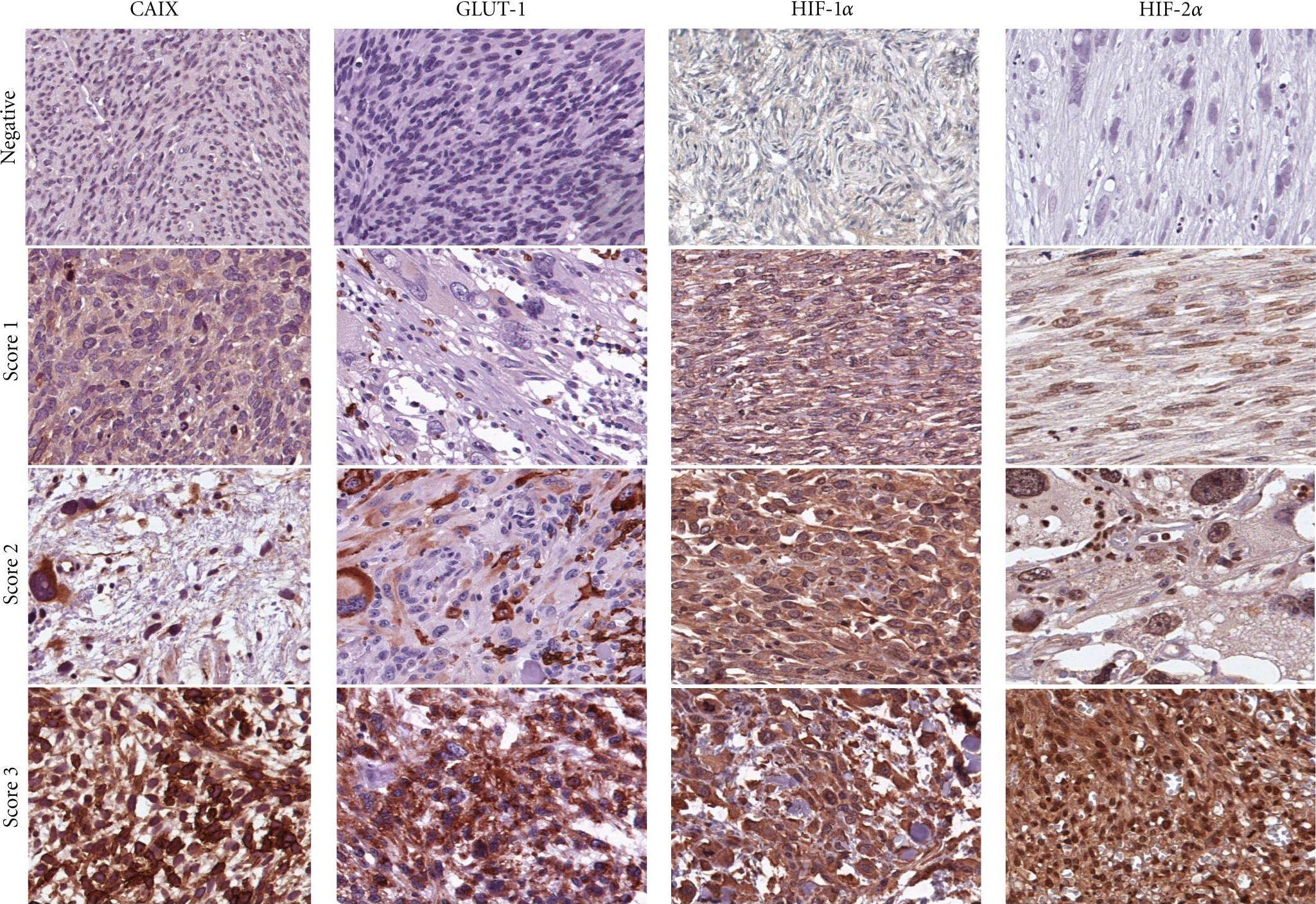 HIF-1 alpha Antibody (ESEE122)