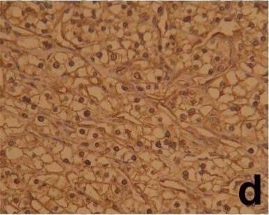 HIF-1 alpha Antibody (ESEE122)