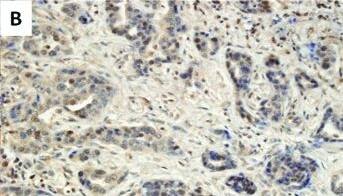 HIF-1 alpha Antibody (ESEE122)