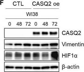HIF-1 alpha Antibody (ESEE122) - BSA Free