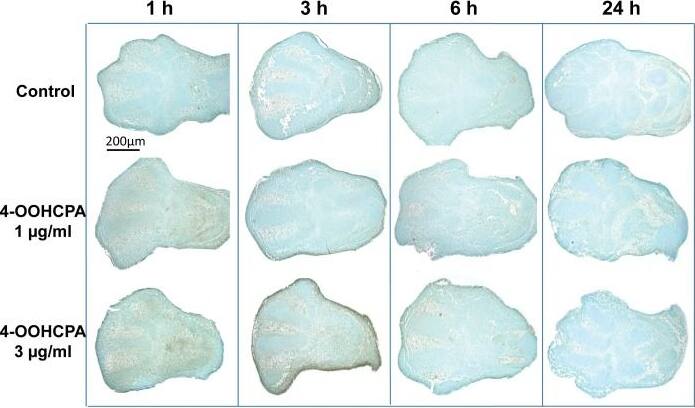 HIF-2 alpha/EPAS1 Antibody (ep190b)